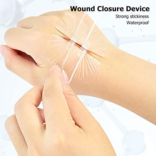 Yosoo Secure Zatvaranje rane sa patentnim zatvaračem, hitni ljepilo za kožu 2 komada Zaštita zip šavove