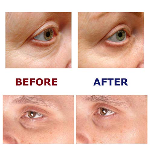 Pod kremom za popravku očiju - sve-trans-retinol pod očima za oči za oči protiv starenja za tamne krugove